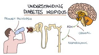 Understanding Diabetes Insipidus [upl. by Fabron995]