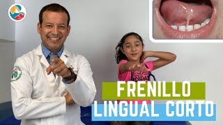 FRENILLO LINGUAL CORTO [upl. by Arawaj]