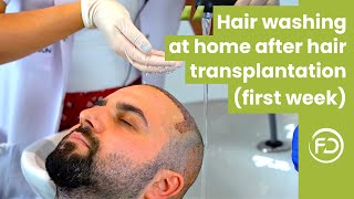 Hair Washing Procedure at Home After Hair Transplantation First Week  Tutorial [upl. by Birkner948]