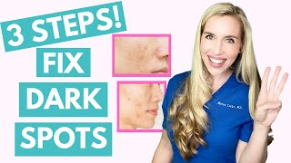 Fix Your Dark Spots in 3 Steps  Hyperpigmentation  Melasma  Skincare Made Simple [upl. by Otrebogir250]