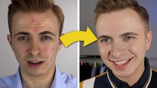 How I Transformed My Face  Best Mens Face Moisturizer [upl. by Einnos]