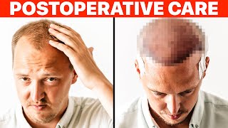 Hair Transplant PostOp Recovery [upl. by Yhprum]