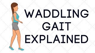 Waddling Gait Explained [upl. by Ida560]