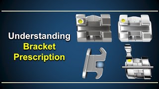 Understanding Bracket Prescription [upl. by Niuqaoj]