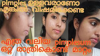 How To Remove Pimples Overnight Malayalam  Remove Pimples Within One day  How To Remove Acne Marks [upl. by Omar134]